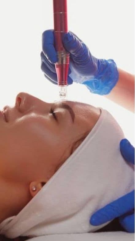 Dermapen Anti Age