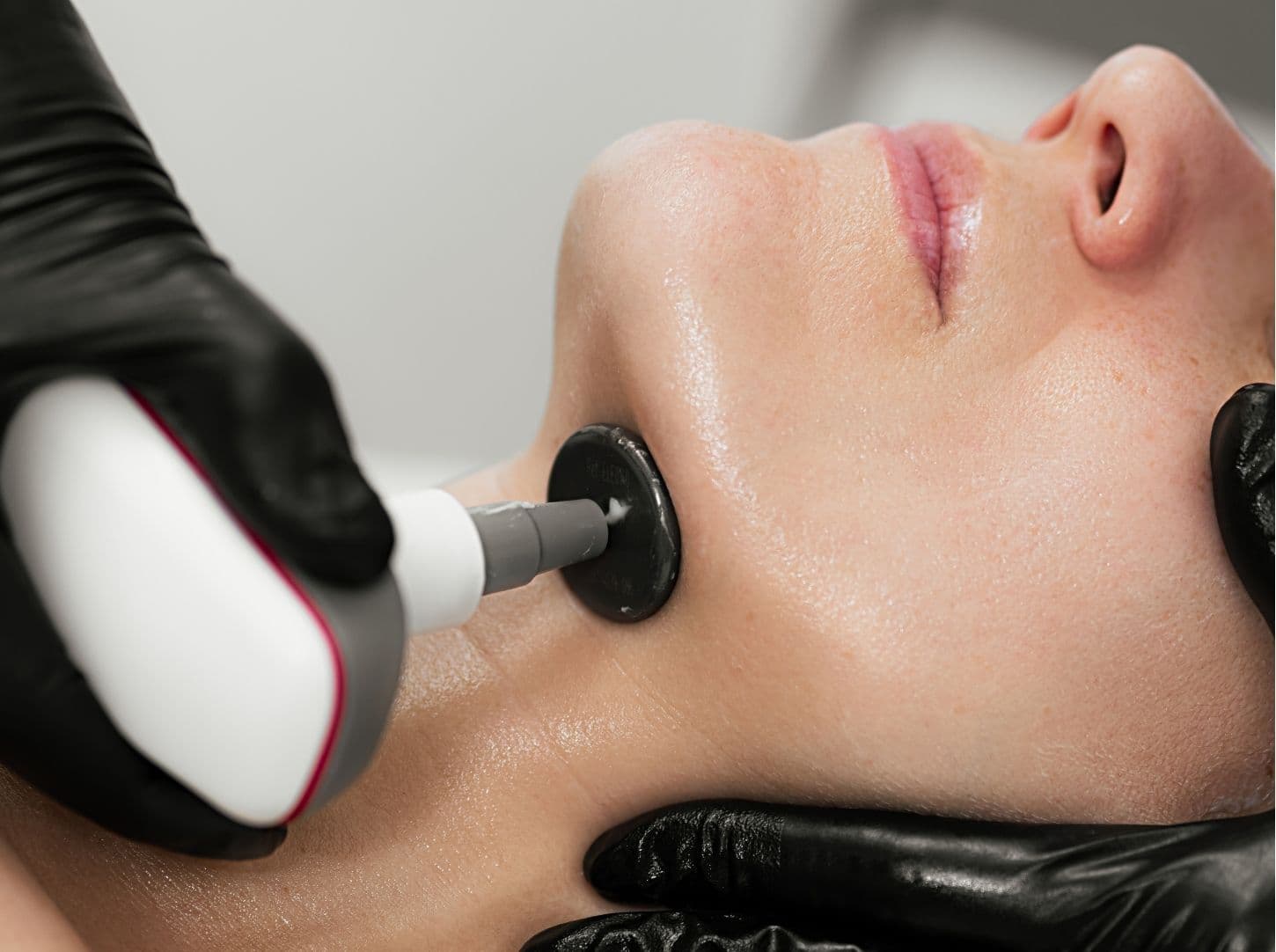 INDIBA Facial
